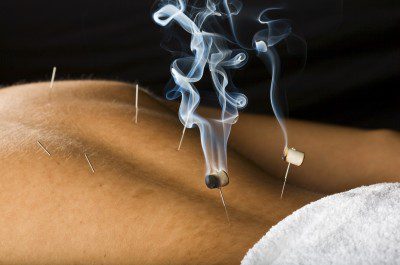 Needle head moxa Needle head Moxibustion treatment
